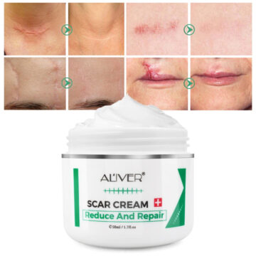 Aliver Reduce and Repair Cream for Scar Remove Treatment