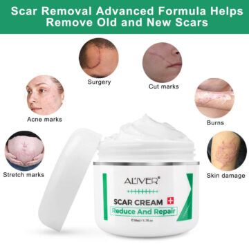 Aliver Reduce and Repair Cream for Scar Remove Treatment