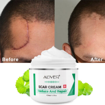 Aliver Reduce and Repair Cream for Scar Remove Treatment