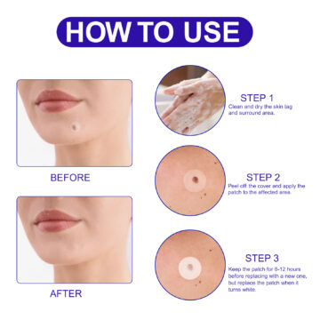 Aliver Skin Tag Remover Patches for Body Face 180 counts