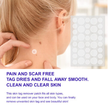 Aliver Skin Tag Remover Patches for Body Face 180 counts